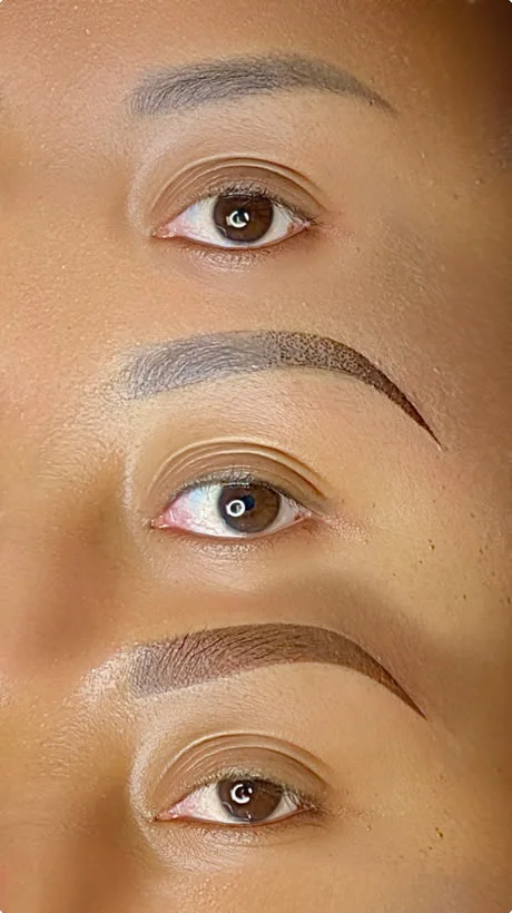 Pigmentation