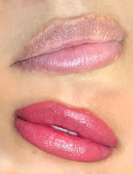 Dark Lip Equalization