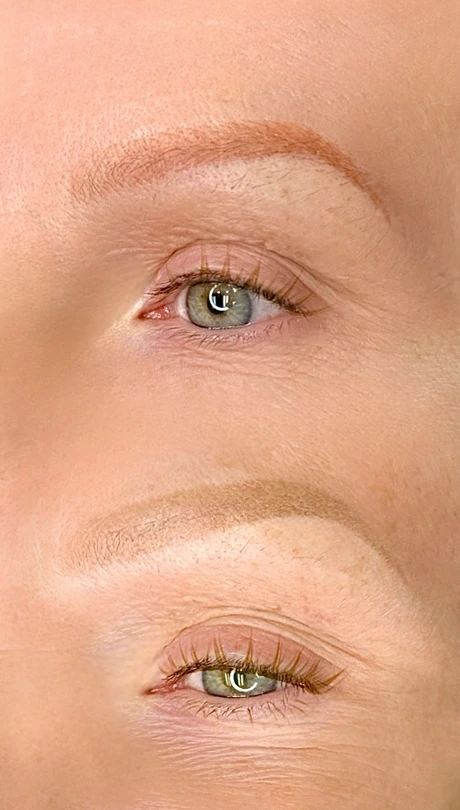 Red Brow Correction